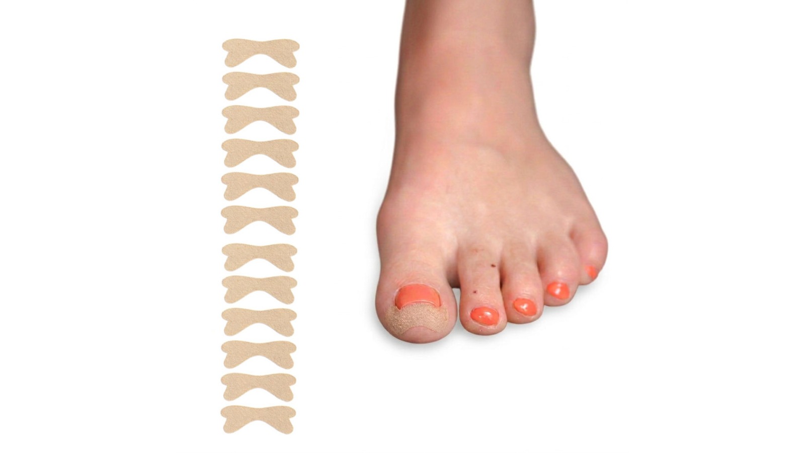 Caremax Pack of 12 Ingrown Toenail Correction Patch