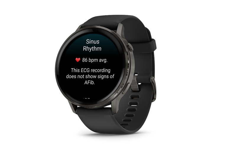  Detailed Monitoring 